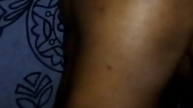 Discharge on buttocks