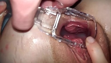 Taboo Hentai Schoolgirl Fucked Inside A Gyno Speculum  freckledRED